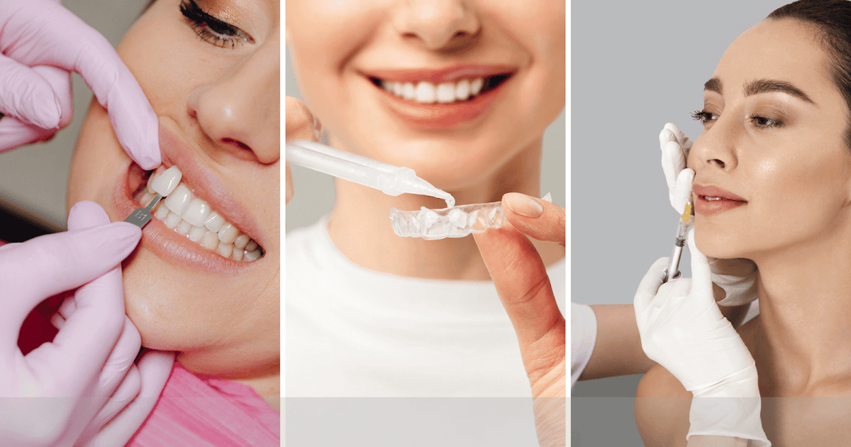 Enhancing Your Facial Profile: How Cosmetic Dentistry Can Help